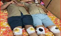 स्टंटबाजों को पकड़ने गए दो सब इंस्पेक्टर घायल- अस्पताल में भर्ती