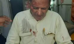 तेज रफ्तार वाहन ने पूर्व बीजेपी विधायक को टक्कर मार पहुंचाया अस्पताल तेज रफ्तार वाहन ने पूर्व बीजेपी विधायक को टक्कर मार पहुंचाया अस्पताल