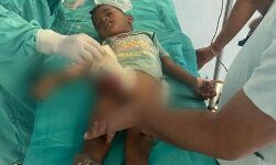 पेट से आर पार हुए सरिए के बावजूद मासूम ने मौत को दी ऐसे मात पेट से आर पार हुए सरिए के बावजूद मासूम ने मौत को दी ऐसे मात