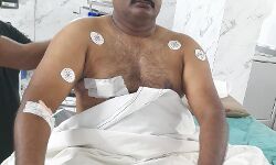 बाइक सवार 3 बदमाशों ने दरोगा को मारी गोली- पिस्टल व पर्स लूटे