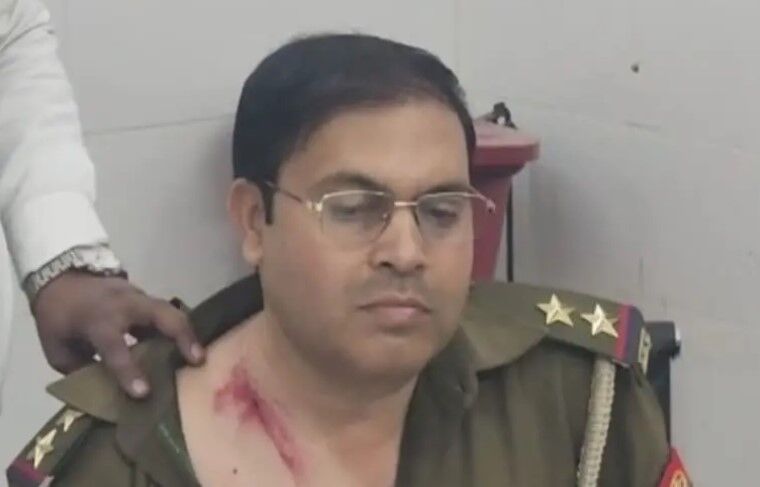 दबिश देने गई पुलिस पर हमला- दरोगा समेत तीन घायल- ऐसे बची जान