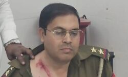 दबिश देने गई पुलिस पर हमला- दरोगा समेत तीन घायल- ऐसे बची जान दबिश देने गई पुलिस पर हमला- दरोगा समेत तीन घायल- ऐसे बची जान