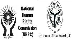 एनएचआरसी ने गलत ऑपरेशन पर यूपी सरकार को किया नोटिस जारी एनएचआरसी ने गलत ऑपरेशन पर यूपी सरकार को किया नोटिस जारी