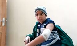 खूंखार हुए कुत्ते का मासूम पर हमला- गंभीर रूप से हुआ घायल खूंखार हुए कुत्ते का मासूम पर हमला- गंभीर रूप से हुआ घायल