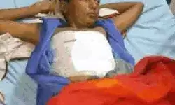 गेम खेलते समय मोबाइल में हुआ ब्लास्ट- बच्चे की हुई ऐसी हालत