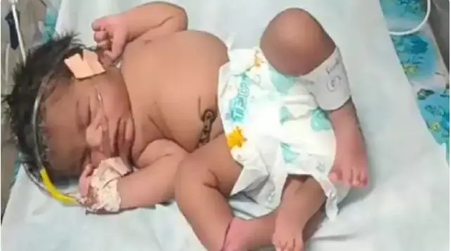 महिला ने चार पैर वाली बच्ची को दिया जन्म- देखने को उमड़ रही भीड़