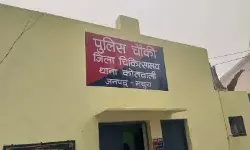 मुठभेड़ में घायल कर गिरफ्तार किया बदमाश पुलिस कस्टडी से फरार