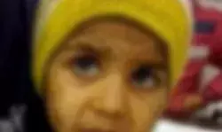 सौतेली मां ने बेरहमी से पीटा- बच्ची की हालत देखकर पिता के छलक पड़े आंसू