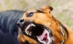 आवारा कुत्ते के हमले से जख्मी हुई बच्ची- डॉक्टर ने लगाये 14 टांके आवारा कुत्ते के हमले से जख्मी हुई बच्ची- डॉक्टर ने लगाये 14 टांके