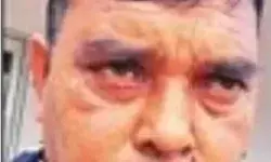 घूसखोर गन्ना पर्यवेक्षक गिरफ्तार- किसान से कर रहा था रुपए वसूल