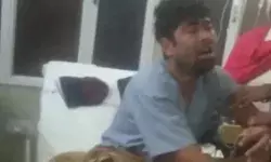 झगड़े में पत्नी ने दांतो से काटी पति की जीभ- डॉक्टरों ने ऐसे जोड़ा झगड़े में पत्नी ने दांतो से काटी पति की जीभ- डॉक्टरों ने ऐसे जोड़ा