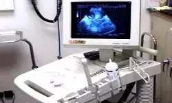 कलेक्टर का एक्शन- भ्रूण लिंग की जांच करने वाले 9 सेंटर सील