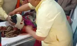 बच्चे की जिंदगी बचाने को मौत से भिड़ गई मां- गुलदार के चंगुल से छुड़ाया बच्चे की जिंदगी बचाने को मौत से भिड़ गई मां- गुलदार के चंगुल से छुड़ाया