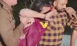 एनकाउंटर में गोली लगते ही बदमाश को याद आ गई मां- रोते हुए बोला..