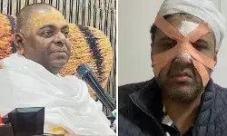 चमत्कार को नमस्कार से किया इंकार- डॉक्टर की पिटाई- बाबा पर एफआईआर