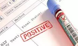 महिला सहित जेल में बंद 44 बंदी मिले HIV पॉजिटिव- मचा हड़कंप महिला सहित जेल में बंद 44 बंदी मिले HIV पॉजिटिव- मचा हड़कंप