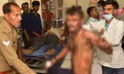 सीएम आवास पर आत्मदाह करने वाले युवक ने तोड़ा दम सीएम आवास पर आत्मदाह करने वाले युवक ने तोड़ा दम