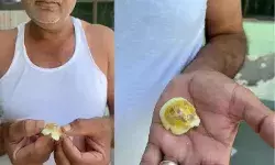 लो प्रोटीन के लिए खालो अंडे- भीतर से निकला प्लास्टिक- शुरू हुई मामले..