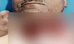 ड्यूटी से लौट रहे एएसआई का कटा गला- आए 74 टांके- हालत गंभीर