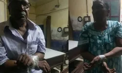 डॉक्टर दंपति को बंधक बनाकर लूटपाट- मरीज बनकर पहुंचे थे बदमाश