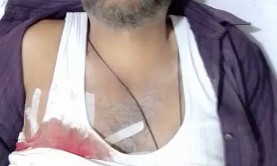 नकाबपोशों का बाइक सवार पर हमला- चाकू से प्रहार कर किया जख्मी