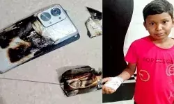 मोबाइल में हुए ब्लास्ट से लगी आग- झुलस गया बालक का हाथ