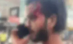 नमाज पढ़कर लौट रहे युवक पर जानलेवा हमला- धारदार हथियार से वार