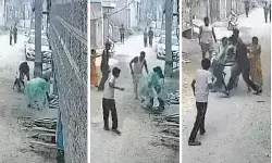 पिटबुल का महिला पर हमला- देखता रहा पड़ोसी- नोचता रहा कुत्ता पिटबुल का महिला पर हमला- देखता रहा पड़ोसी- नोचता रहा कुत्ता