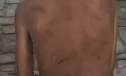 बच्चे की पिटाई मामला-मदरसे के बच्चों ने खोली पोल- मौलाना एवं ताऊ अरेस्ट बच्चे की पिटाई मामला-मदरसे के बच्चों ने खोली पोल- मौलाना एवं ताऊ अरेस्ट