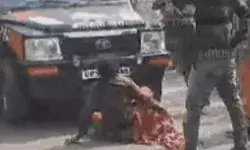 इनामी को पकड़ने पहुंची पुलिस टीम पर हमला- तीन पुलिस कर्मी घायल इनामी को पकड़ने पहुंची पुलिस टीम पर हमला- तीन पुलिस कर्मी घायल