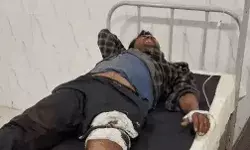 मुठभेड़ में 45 हजार के इनामी वांटेड डकैत को लगी गोली- यूपी और....