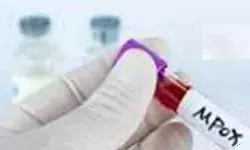 नए मंकीपॉक्स वेरिएंट को लेकर नीदरलैंड में चौकसी नए मंकीपॉक्स वेरिएंट को लेकर नीदरलैंड में चौकसी