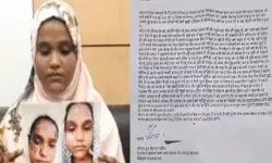 मोदी योगी की तारीफ की तो शौहर ने जलाया चेहरा दिया तीन तलाक मोदी योगी की तारीफ की तो शौहर ने जलाया चेहरा दिया तीन तलाक