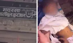कमर और गर्दन पर मिले कई छाले- मदरसे में बच्चे की मौत को लेकर हंगामा