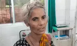 गुलदार के बाद अब सियार का आतंक- जंगल गई महिला पर किया अटैक