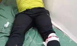 मर्डर करके फरार हाशिम बाबा गैंग के भगौडे बदमाश एनकाउंटर में लंगड़े मर्डर करके फरार हाशिम बाबा गैंग के भगौडे बदमाश एनकाउंटर में लंगड़े