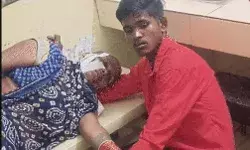 दुर्गा पूजा में जा रही महिला पर भेड़िए का हमला- नोच लिया चेहरा