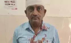 पिस्तौल से घायल कर बाइक सवार से दिन दहाड़े लूट- नकाबपोश.... पिस्तौल से घायल कर बाइक सवार से दिन दहाड़े लूट- नकाबपोश....