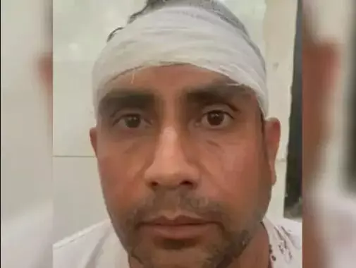 पटाखे फोड़ने को लेकर बवाल- सिपाही व बेटे ने इंजीनियर पर रोड से किया वार पटाखे फोड़ने को लेकर बवाल- सिपाही व बेटे ने इंजीनियर पर रोड से किया वार