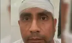 पटाखे फोड़ने को लेकर बवाल- सिपाही व बेटे ने इंजीनियर पर रोड से किया वार पटाखे फोड़ने को लेकर बवाल- सिपाही व बेटे ने इंजीनियर पर रोड से किया वार