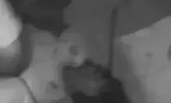 निर्माणाधीन नाले में दोस्तों के साथ बाइक समेत गिरे युवक की आंख में....