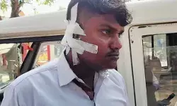 डांस को लेकर बारातियों एवं घरातियों में घमासान- एक युवक का कटा कान डांस को लेकर बारातियों एवं घरातियों में घमासान- एक युवक का कटा कान