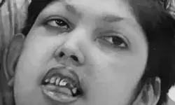 दिव्यांग बच्ची की आग में जिंदा जलकर मौत- घटना के समय माता पिता.... दिव्यांग बच्ची की आग में जिंदा जलकर मौत- घटना के समय माता पिता....