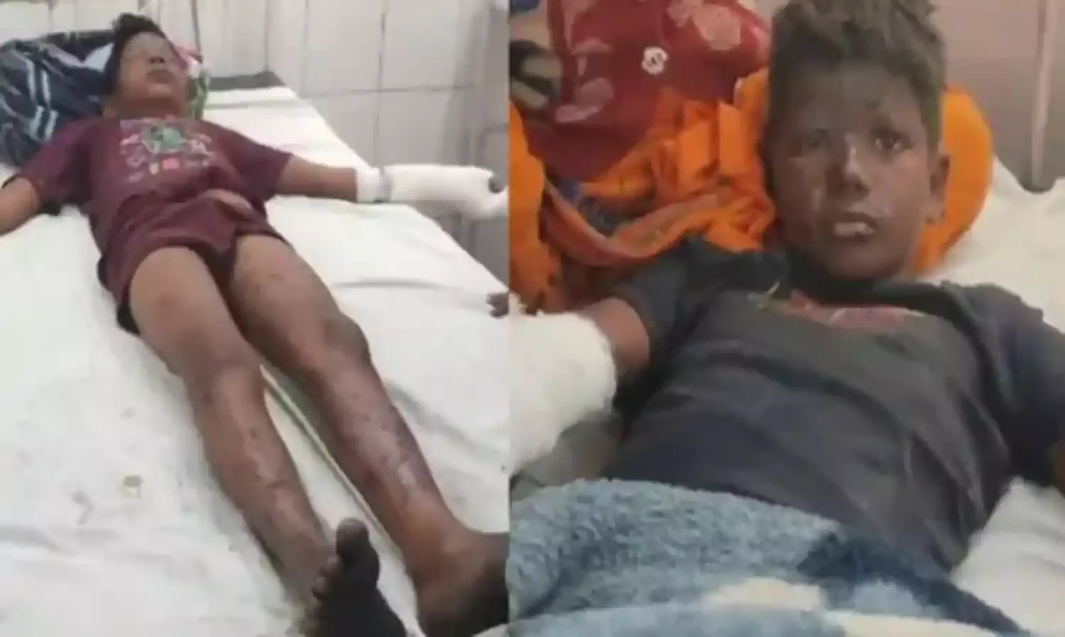 पतंग लूटने दौड़ रहे बच्चे ब्लास्ट से उछले- खेत में पैर रखते ही हुआ धमाका