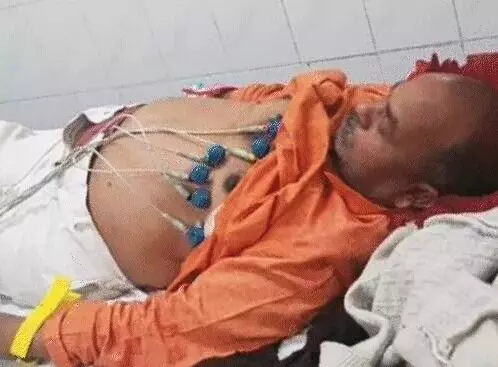 टिकट नहीं मिलने से नाराज भाजपा नेता दिल का दौरा पड़ने से बेहोश