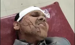 तीन पलटे खाने के बाद बारातियों से भरी बस सीधी खड़ी हुई तीन पलटे खाने के बाद बारातियों से भरी बस सीधी खड़ी हुई