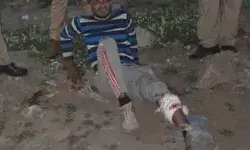 चेन स्नेचर को एनकाउंटर में लगी पुलिस की गोली- लंगड़ा हुए बदमाश को...