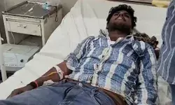 सर्पदंश के शिकार पति का जहर मुंह से निकलने की कोशिश- पत्नी का हुआ.. सर्पदंश के शिकार पति का जहर मुंह से निकलने की कोशिश- पत्नी का हुआ..