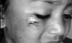 मां बहन के साथ जा रहे 4 साल के मासूम पर कुत्ते ने किया अटैक मां बहन के साथ जा रहे 4 साल के मासूम पर कुत्ते ने किया अटैक