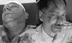 किडनैप पुलिसकर्मियों को छुड़ाने पहुंची पुलिस पर हमला- थानेदार का सिर.. किडनैप पुलिसकर्मियों को छुड़ाने पहुंची पुलिस पर हमला- थानेदार का सिर..